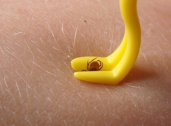 Vous pouvez retirer le parasite attaché avec une pince spéciale...