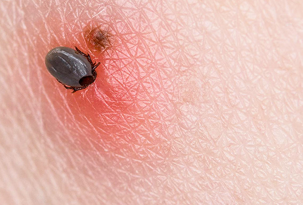 Une tique femelle adulte peut se nourrir d'une personne pendant plusieurs jours.