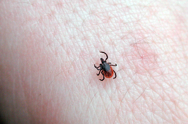 La plupart des remèdes populaires ne repoussent pas les tiques et ne les tuent pas.