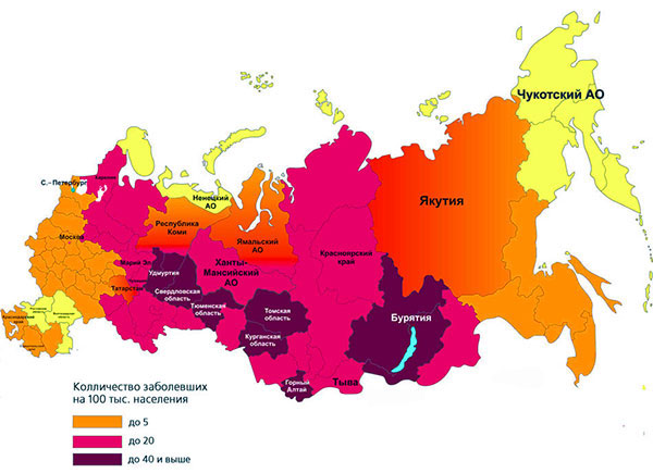 Carte de la distribution de l'encéphalite à tiques en Russie