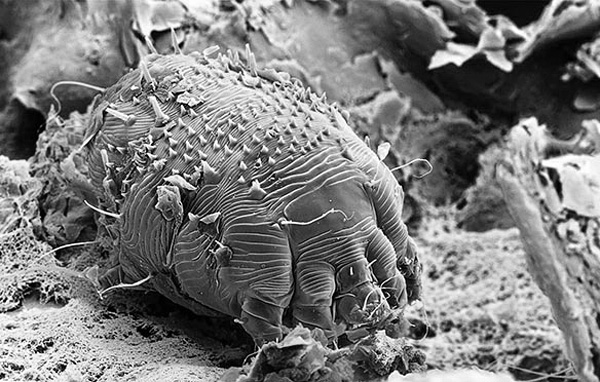 Acarien de la gale au microscope