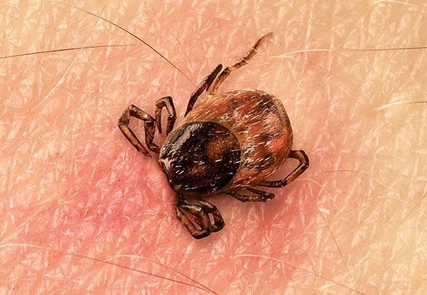 Cochez l'aspiration comme type d'événement assuré