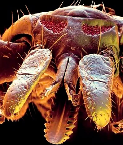 Voici à quoi ressemble l'appareil buccal d'une tique des prés