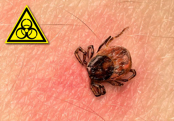 Nous examinons en détail les infections véhiculées par les tiques: modes de transmission, caractéristiques de l'évolution de la maladie et méthodes de traitement efficaces ...