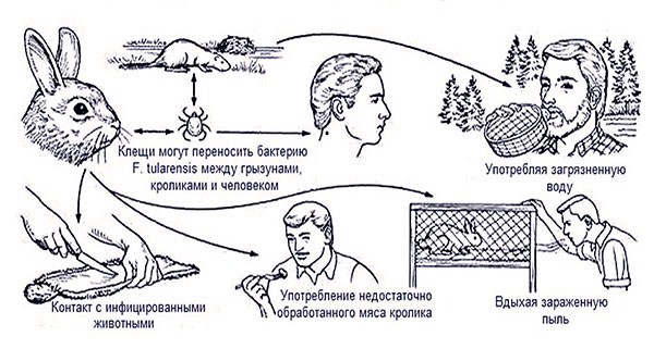 Comment contracter la tularémie ?